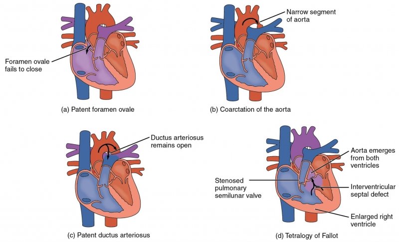 Array of heart illustrations with different defects.