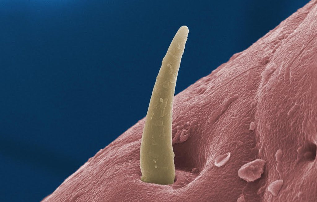 This super close up of a tick's leg hair placed as a runner-up in the JEOL's 2016 SEM/TEM/EPMA Image Contest.