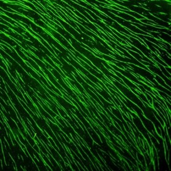 bright green fluorescent microscopic image