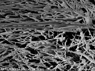 A microscope image of plasma-etched polymer that shows the strands of the polymer.