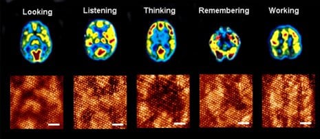 Molecular Processor that Looks Like a Brain Evolving patterns on this molecular processor mimic patterns displayed by the human brain. Anirban Bandyopadhyay image.