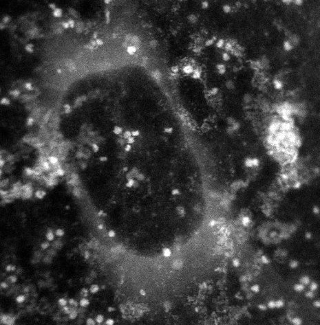The white dots in this electron microscope image are the protein ferritin, trapped in a bubble of liquid in a graphene capsule. Tolou Shokuhfar will use this new technology to study ferritin's inner workings, with the aim of advancing cures for disease.