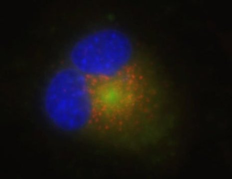 New fluorescent dyes help illuminate lysosome structures. 