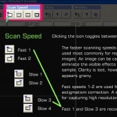 Scan speed