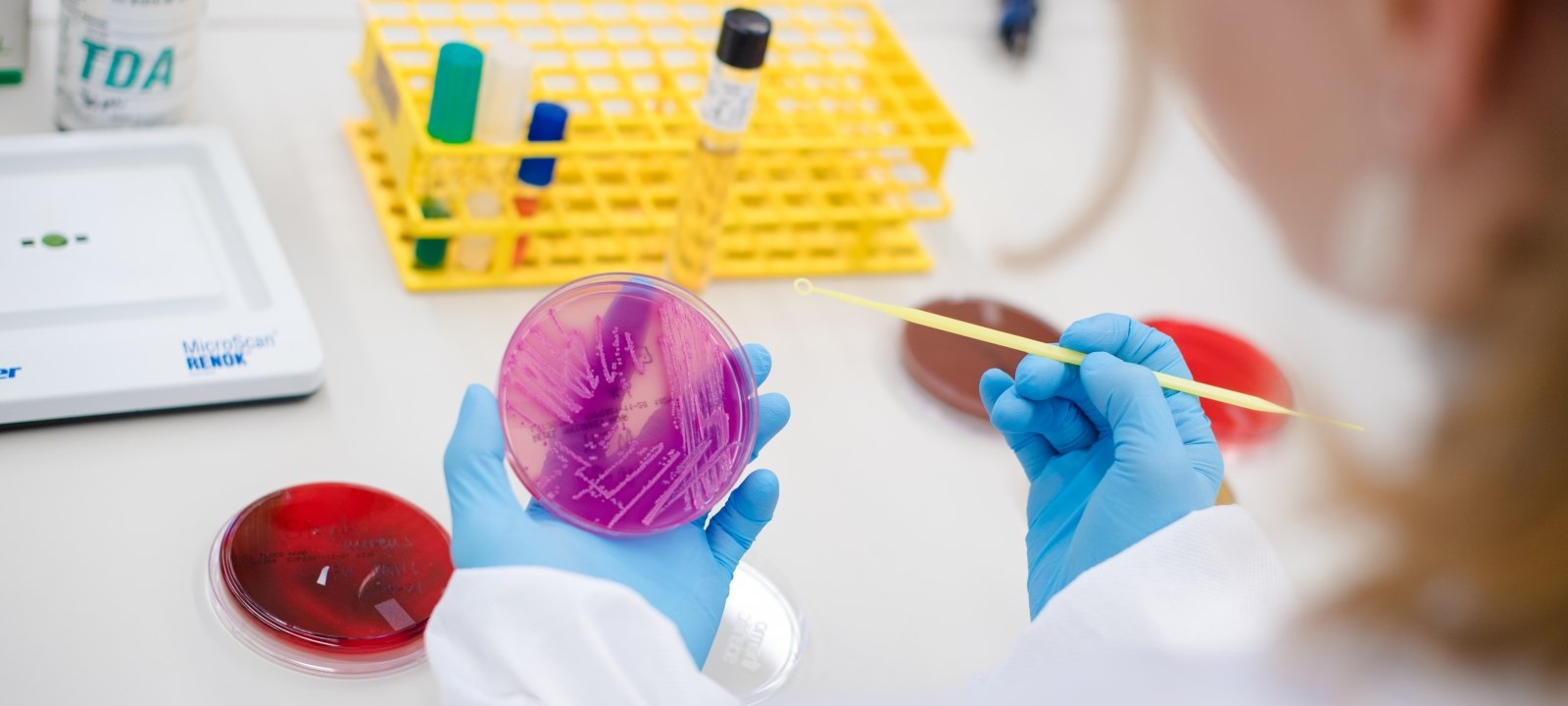 Student reading a microbiology plate