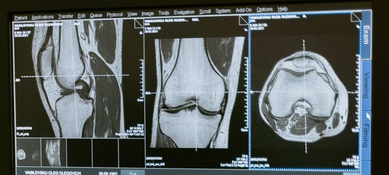 Medical Imaging