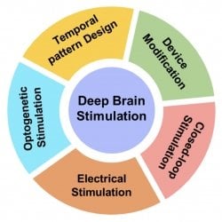 Deep Brain Stimulation components graphic.