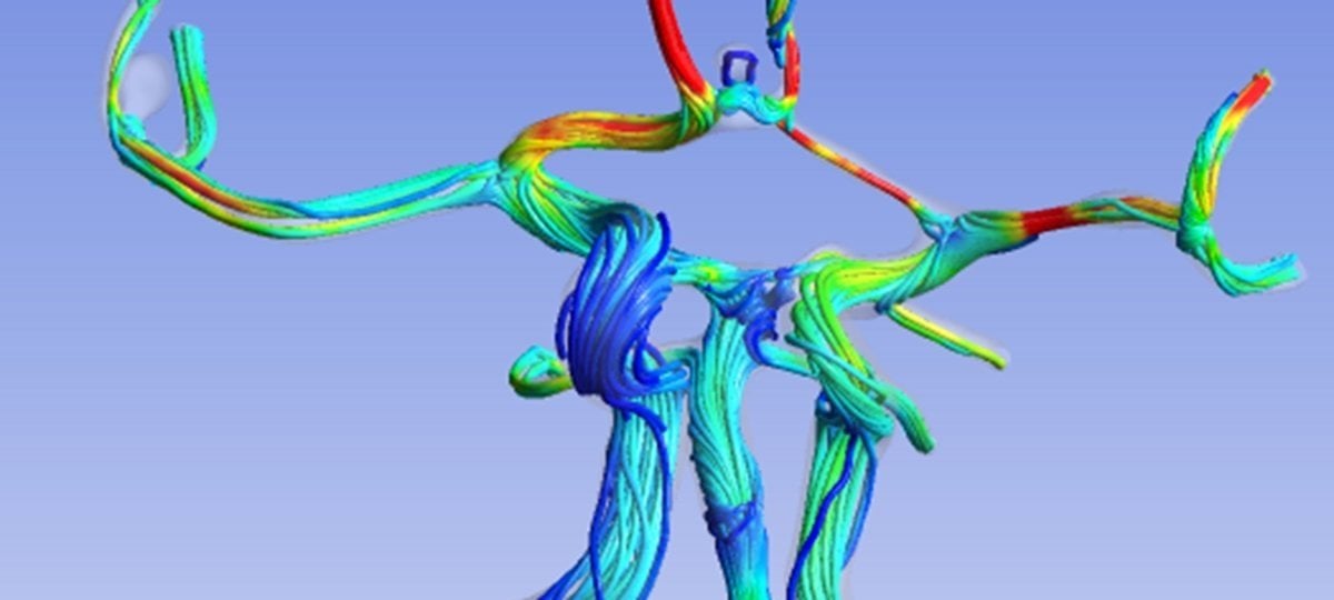 Cardiovascular Engineering showing streamflow visualization.