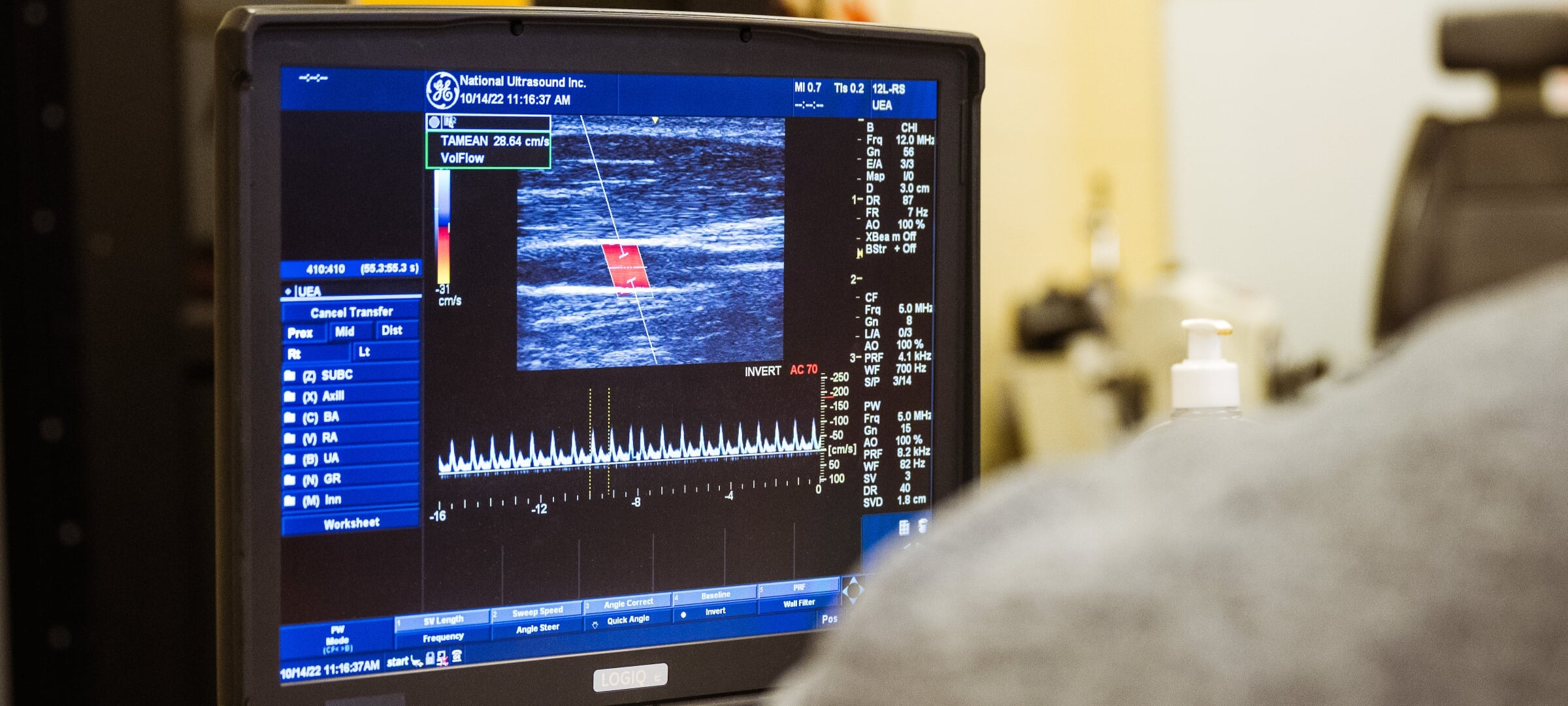 A screen showing an ultra sound image, seen over the shoulder of the technician reading it.