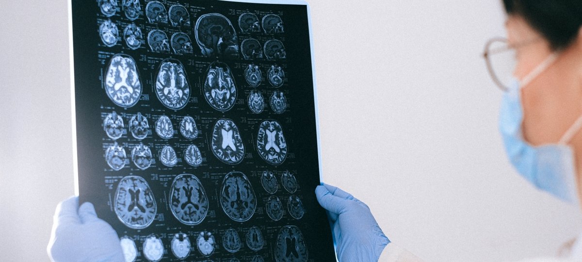 Technician with mask and gloves looking at an x-ray of the brain.