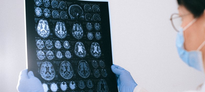 Medical technician holding and looking at an x-ray.