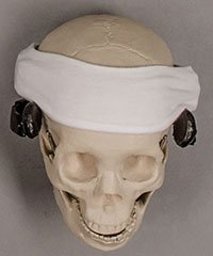sleep apnea device on a model skull