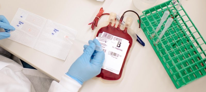 Labelling a bag of B positive donated blood.