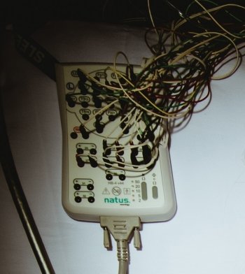 Box with many wires attached.