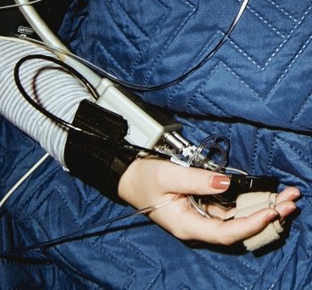 Participant's right hand with device attached.