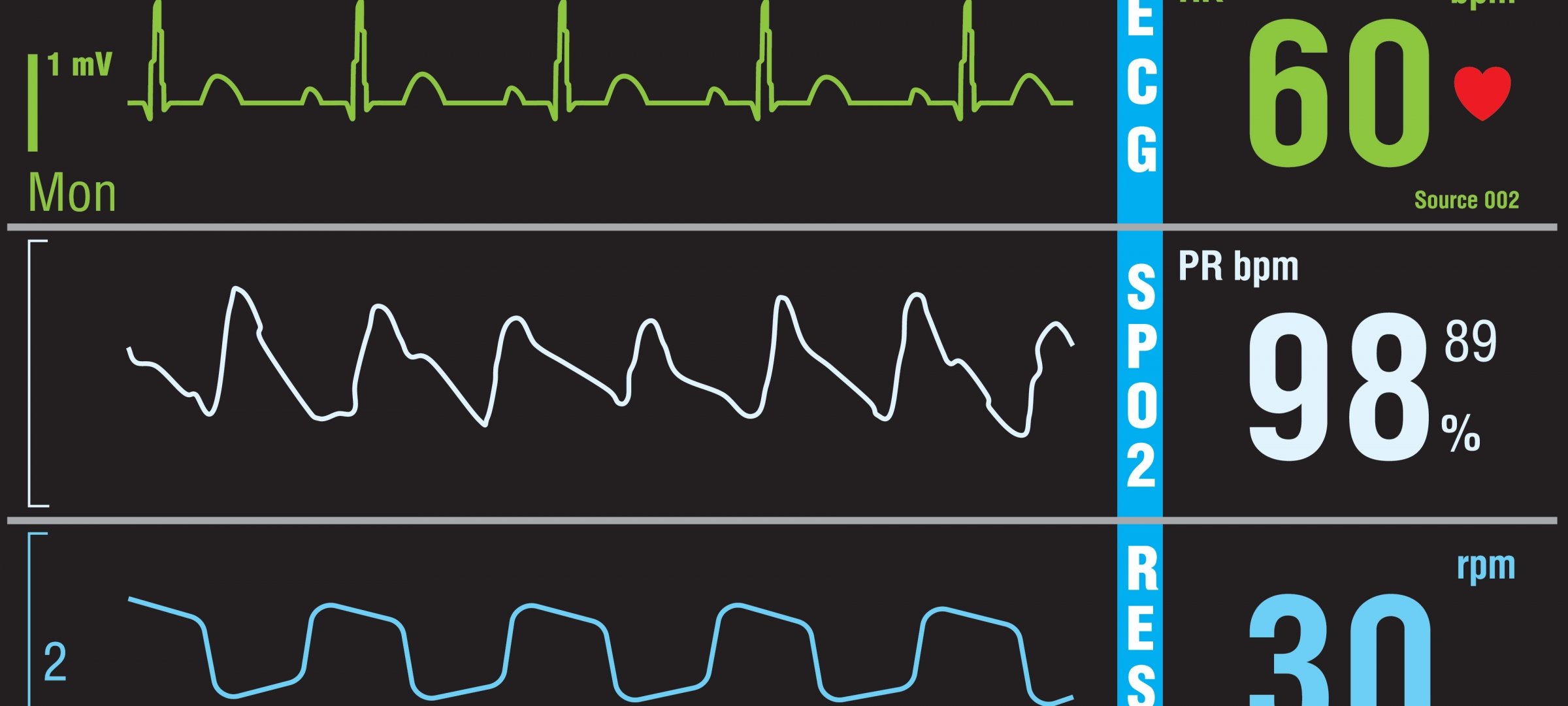 Heart monitor screen.