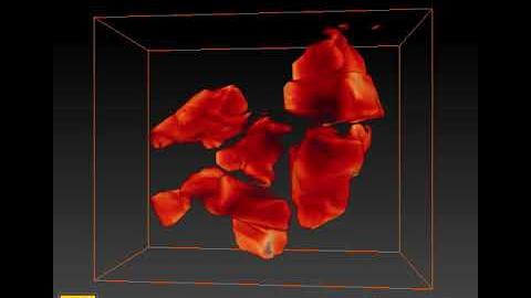 Preview image for STEM Tomography of Li-ion Battery Cathode Particles video