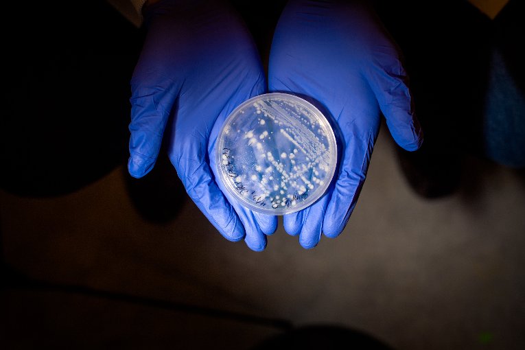 Bilge Micro Petri Dish Cultures from bilge water samples reveal the invisible microbial communities that could identify one port from another.