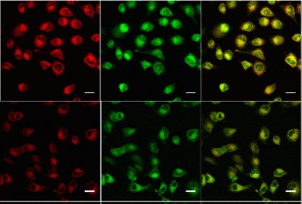 Haiying Liuï¿½s acid-sensitive luminescent probe glows progressively brighter in living cells as the pH decreases, both under conventional fluorescence (CF) and under single-photon upconversion luminescence (FUCL).