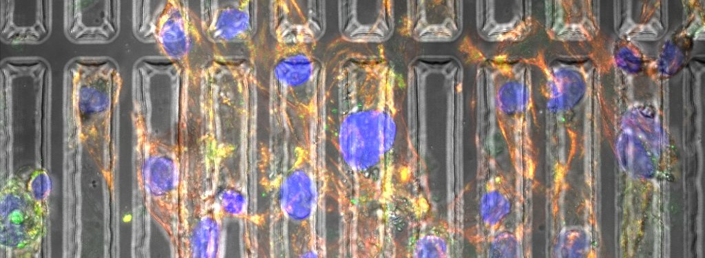 Heart muscle cells in cylindrically shaped growth substrate.