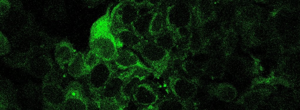 Circular cells light up with green fluorescence