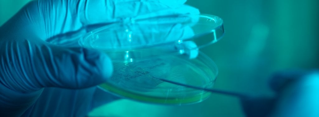 gloved hand holding pipette and petri dish