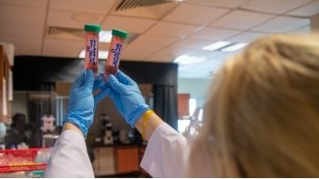 gloved hands holding up vials with faint pink liquid