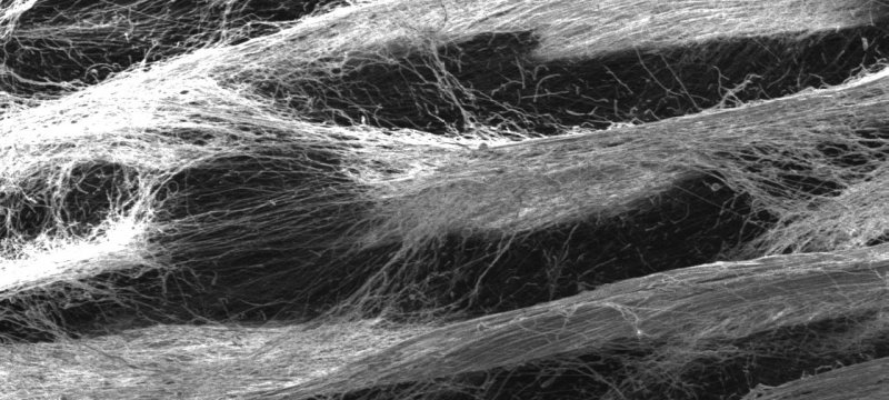 A microscopic image of honeycomb polycaprolactone scaffold.