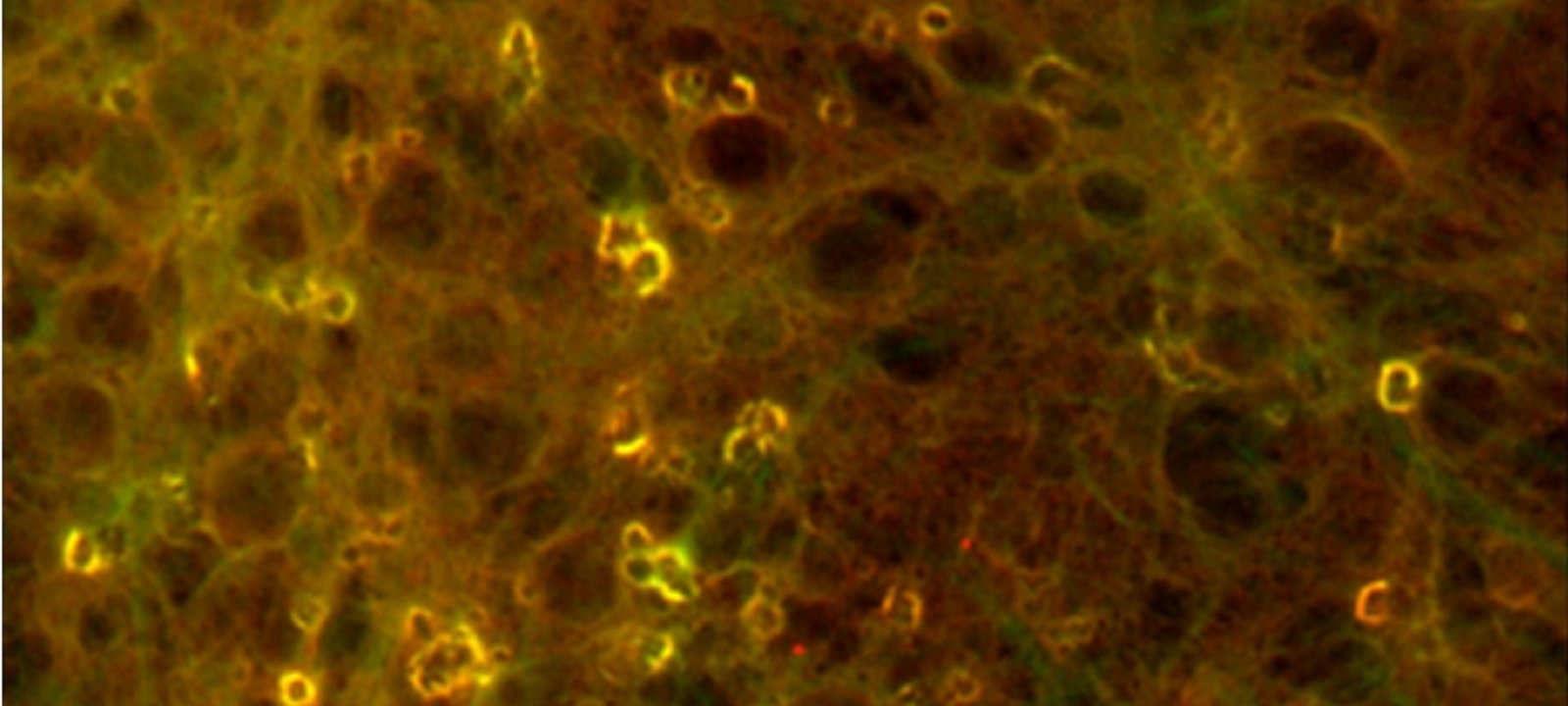 Newswise: Protein Shapes Matter in Alzheimer's Research
