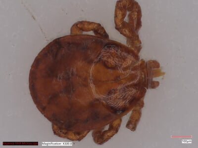 A high-resolution color image of a winter tick from above, at 300 times magnification.