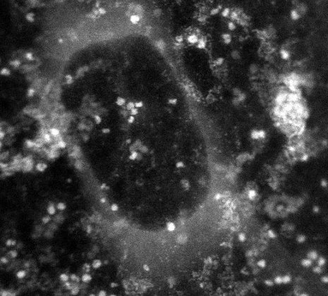 In this image generated by an electron microscope, the white dots are the protein ferritin. The dark circle in the middle is a bubble of liquid trapped within the graphene capsule enclosing the sample.