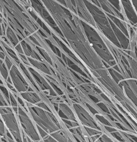 Highly aligned nano-fibers created by fibroblasts form a biological scaffold which could prove an ideal foundation for engineered tissues. Stem cells placed on the scaffold thrived, and it had the added advantage of provoking a very low immune response.