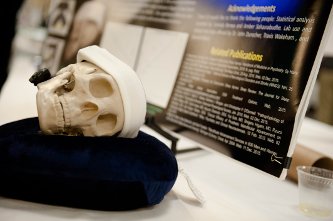Design Expo Day Sleep disorder no more: A truly jaw-dropping display of a senior design team's device for mild apnea.