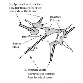 tumor-control4