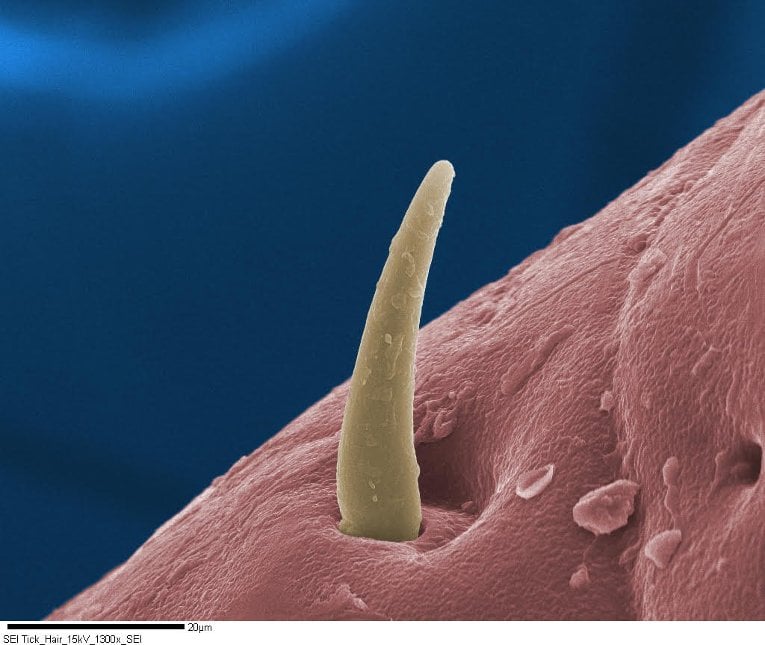 Tick Main This super close up of a tick's leg hair placed as a runner-up in the JEOL's 2016 SEM/TEM/EPMA Image Contest.
