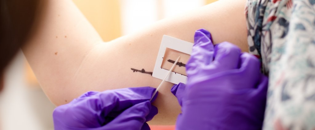 Wearing lab gloves, a graduate students uses a thin pipette and black lines to lay lotion on a study participant's upper arm.