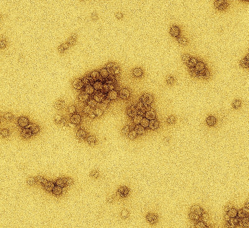 TEM image of clusters of MS2 bacteriophage.