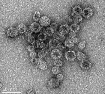 A transmission electron microscope image of Zika virus envelope protein gene.