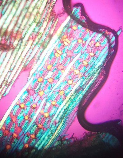 Eastern hemlock cells under a polarized light microscope.