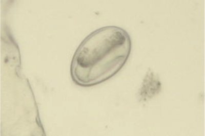 A microscopic image of a parasitic worm ovum.
