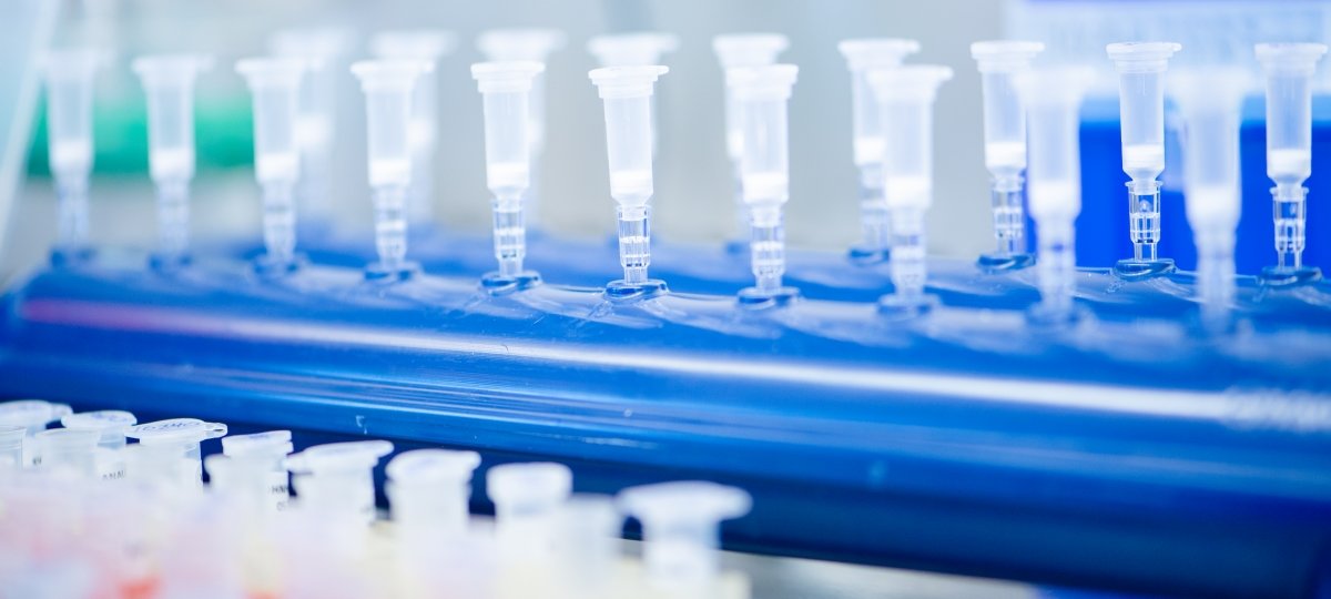 Plastic diagnostic sample tubes neatly lined up in a holder.